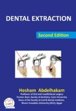Dental Extraction Second Edition