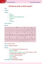 Tips and Tricks in ECG Basic Level - Image 8