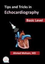 Tips and Tricks in Echocardiography Basic Level