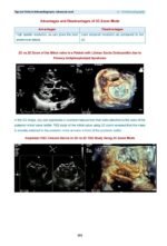 Tips and Tricks in Echocardiography Advanced Level - Image 4