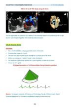Tips and Tricks in Echocardiography Advanced Level - Image 5