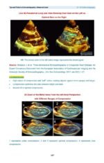 Tips and Tricks in Echocardiography Advanced Level - Image 8